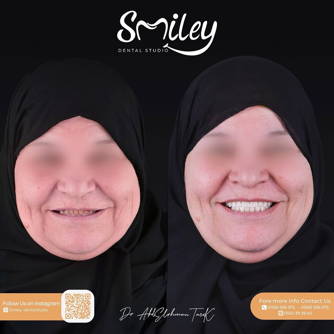 537489778_18086748763840430_620162181010401145_n